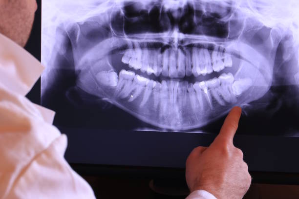 Tooth Infection Emergency Dentist in UT
